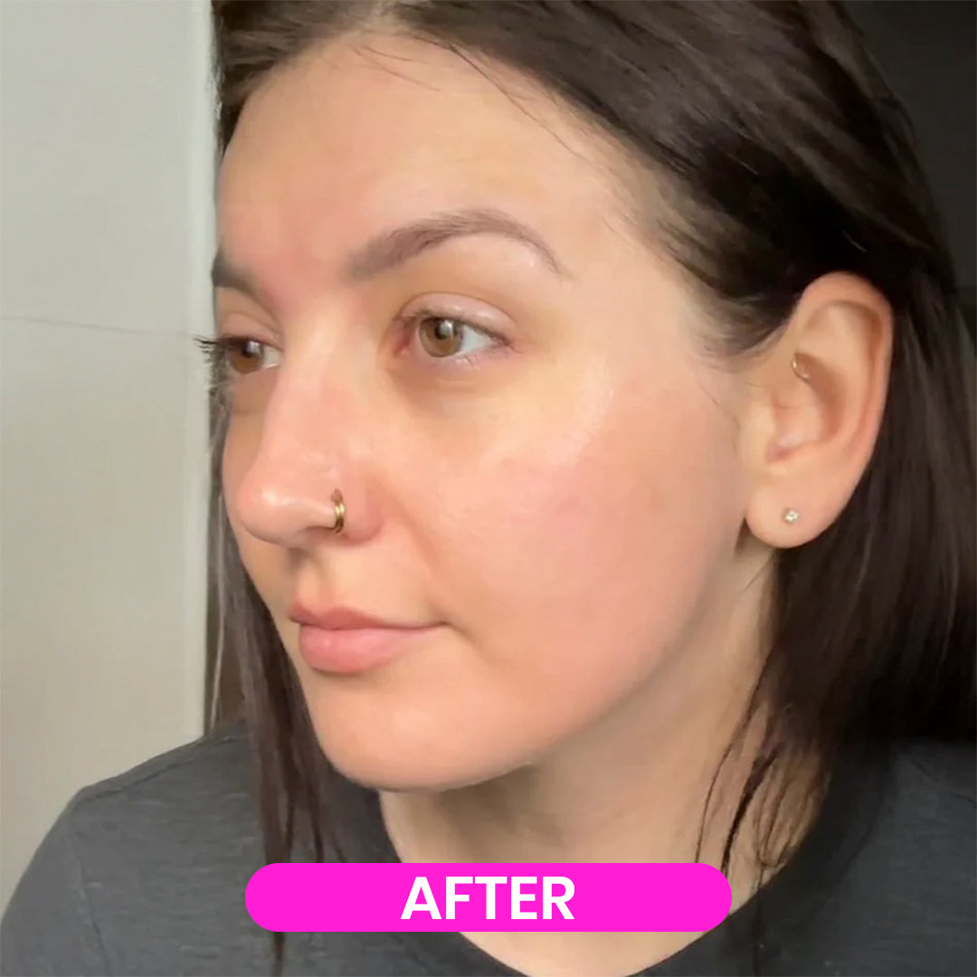Mónare 4% Retinal Liposome Cream
