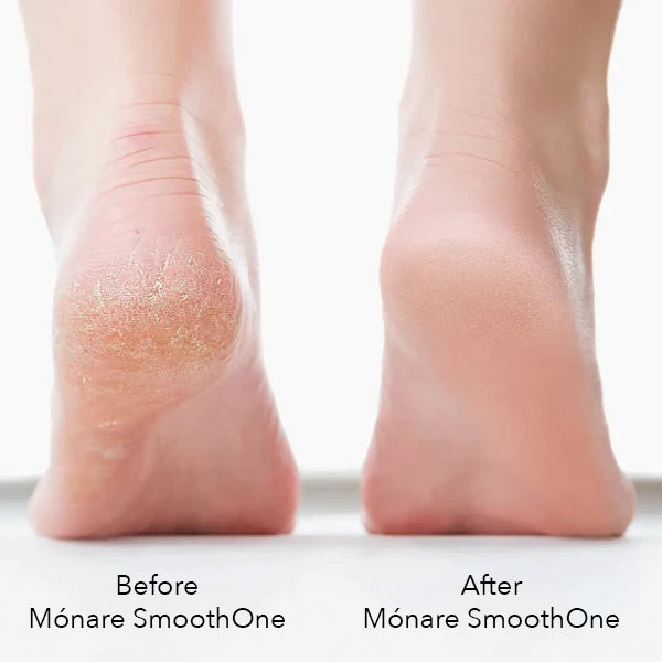Mónare SmoothOne - Silky Soft Feet in Minute - Remove Calluses and Cracks Without Pain